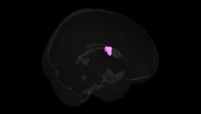 Full Brain Black