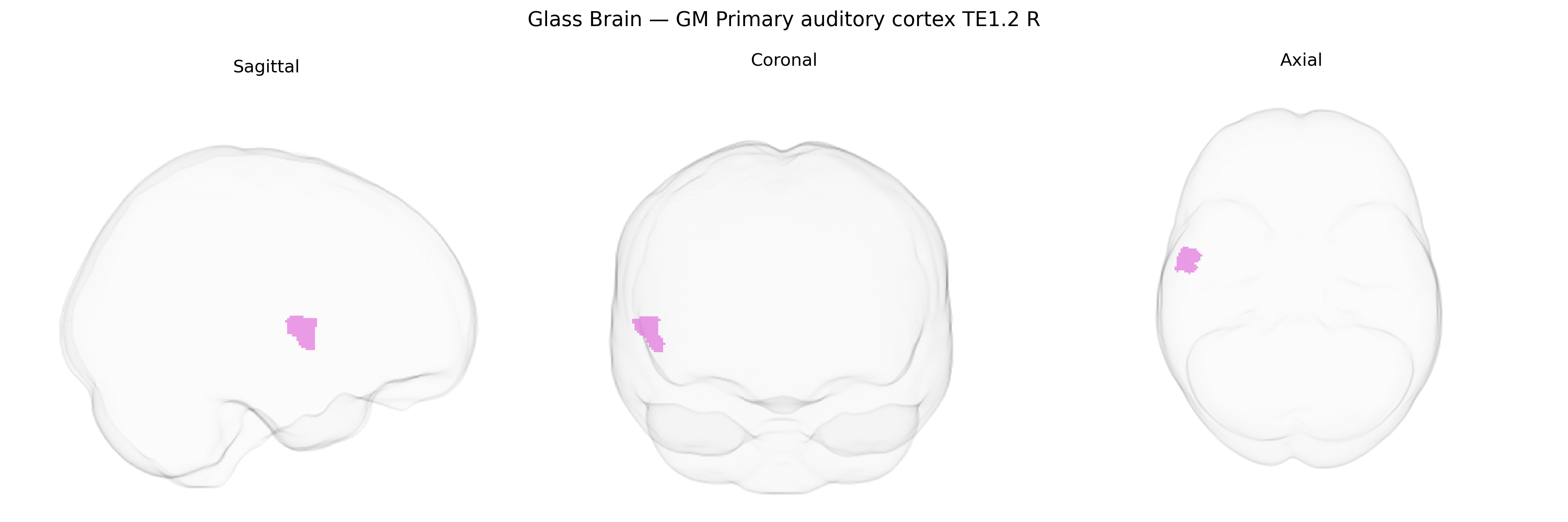 Triplanar Ghost Brain