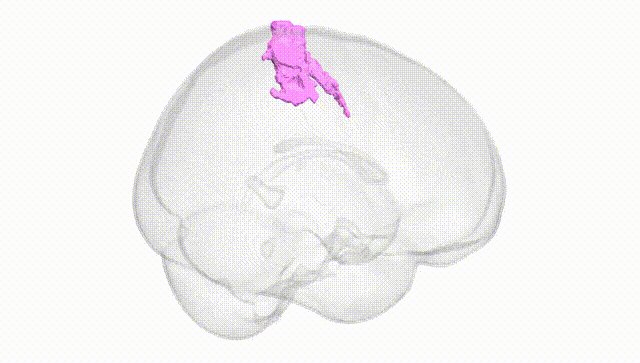 Full Brain White