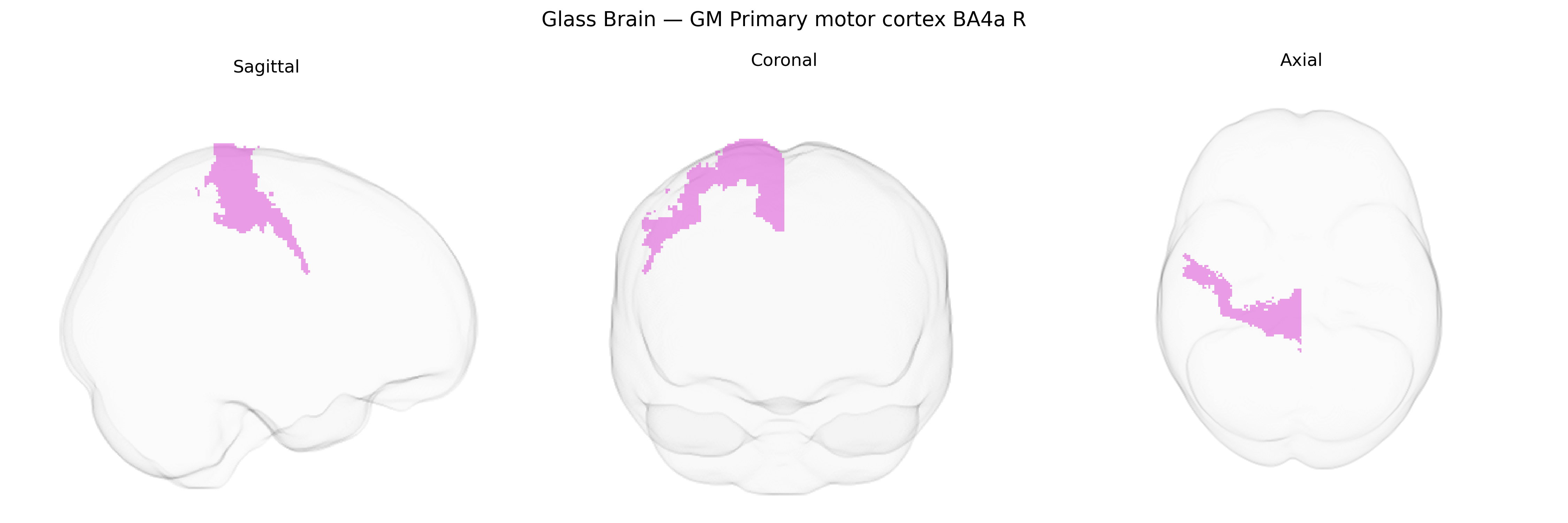 Triplanar Ghost Brain