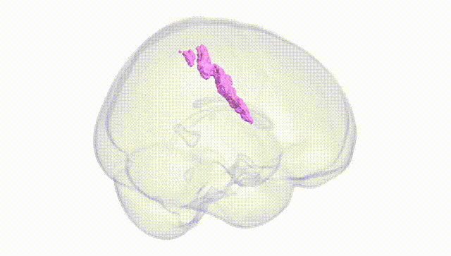 Full Brain White