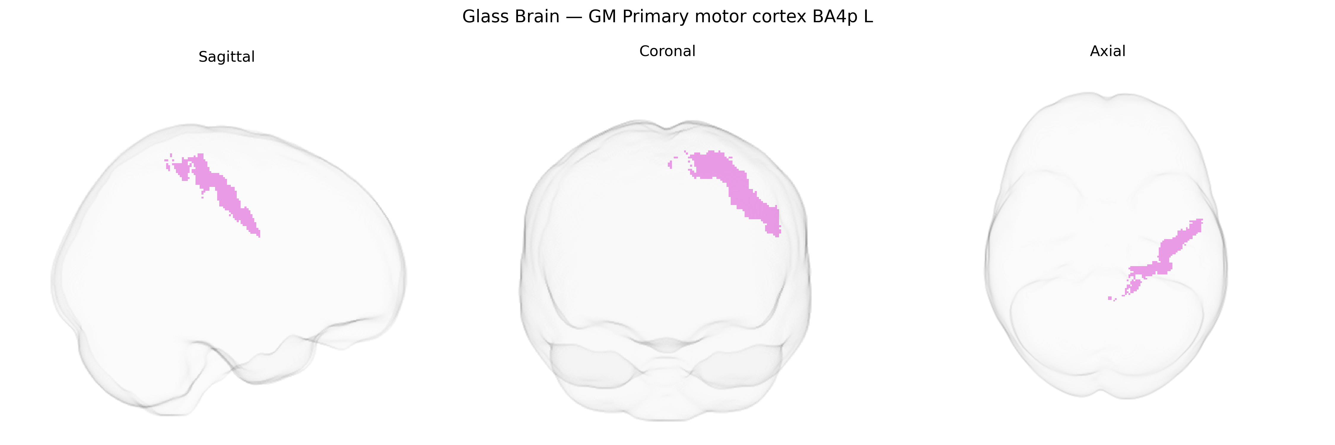 Triplanar Ghost Brain