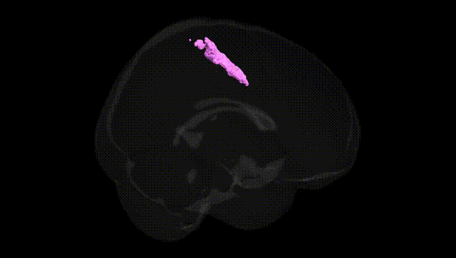Full Brain Black