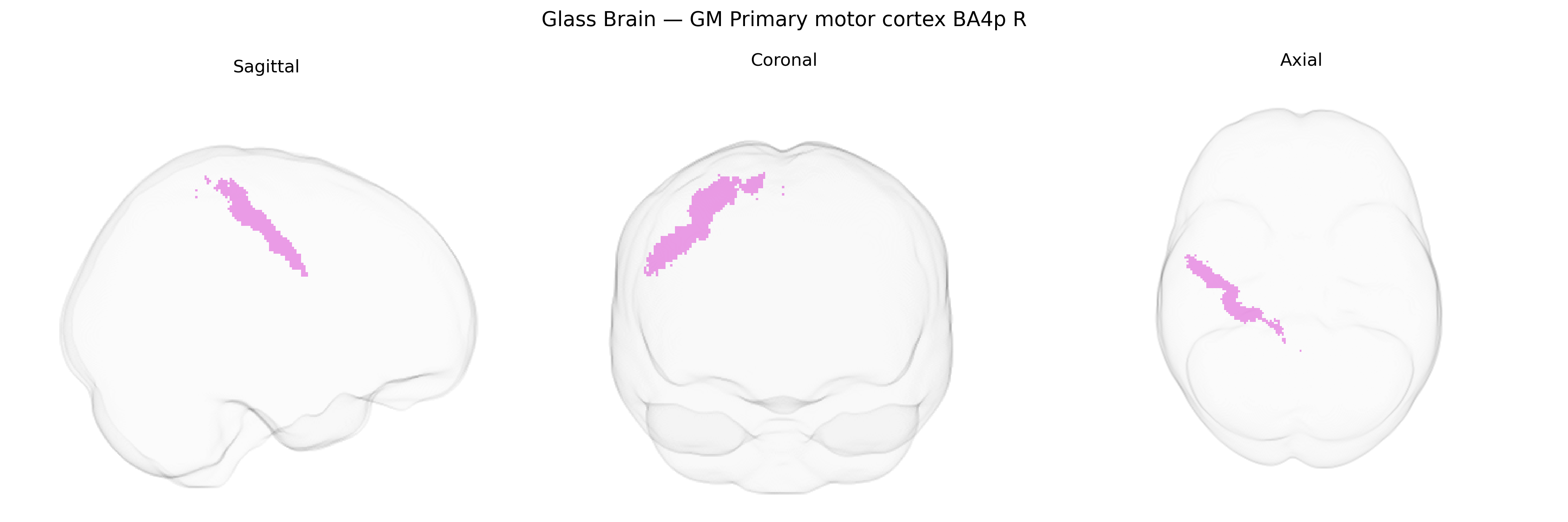Triplanar Ghost Brain