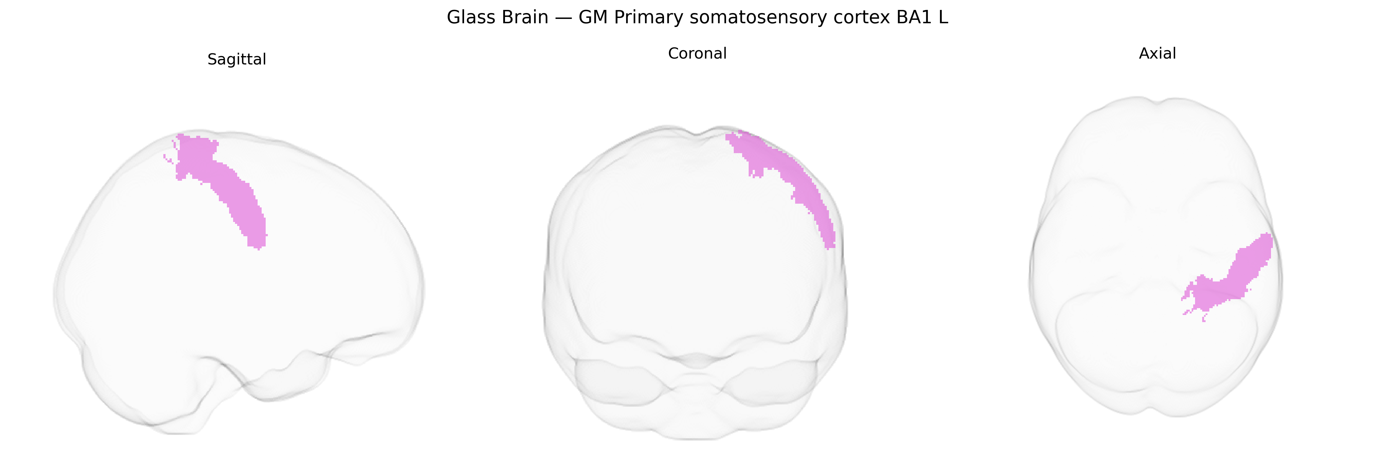 Triplanar Ghost Brain