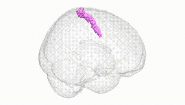 Full Brain White
