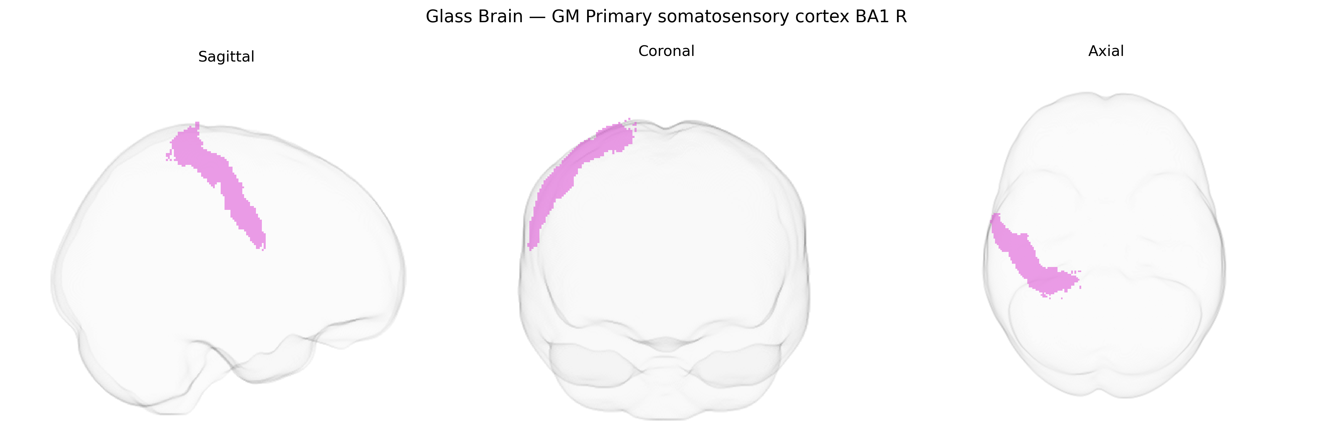 Triplanar Ghost Brain