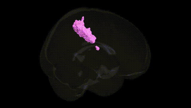 Full Brain Black