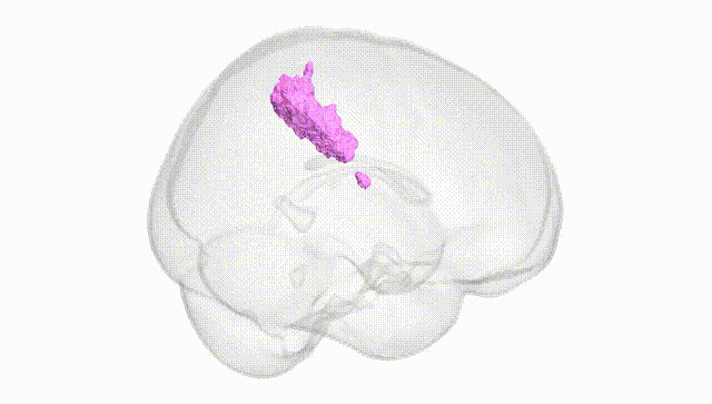 Full Brain White