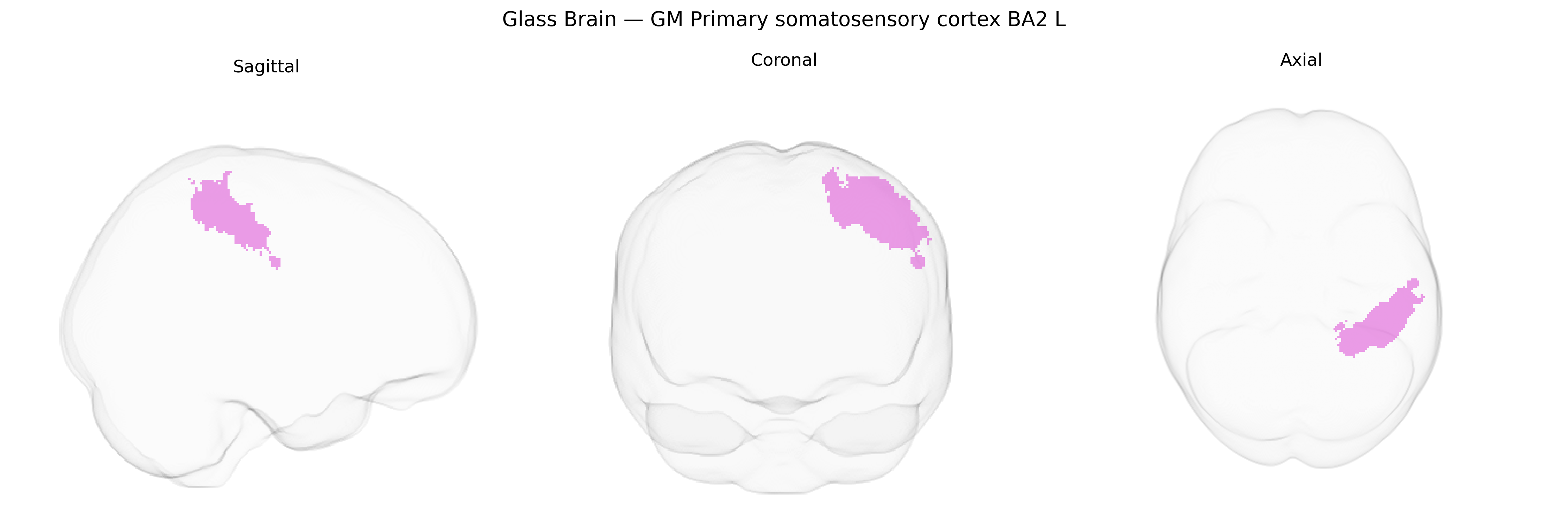 Triplanar Ghost Brain