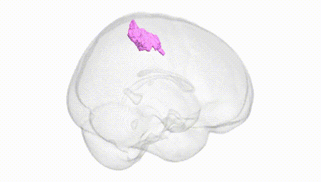 Full Brain White