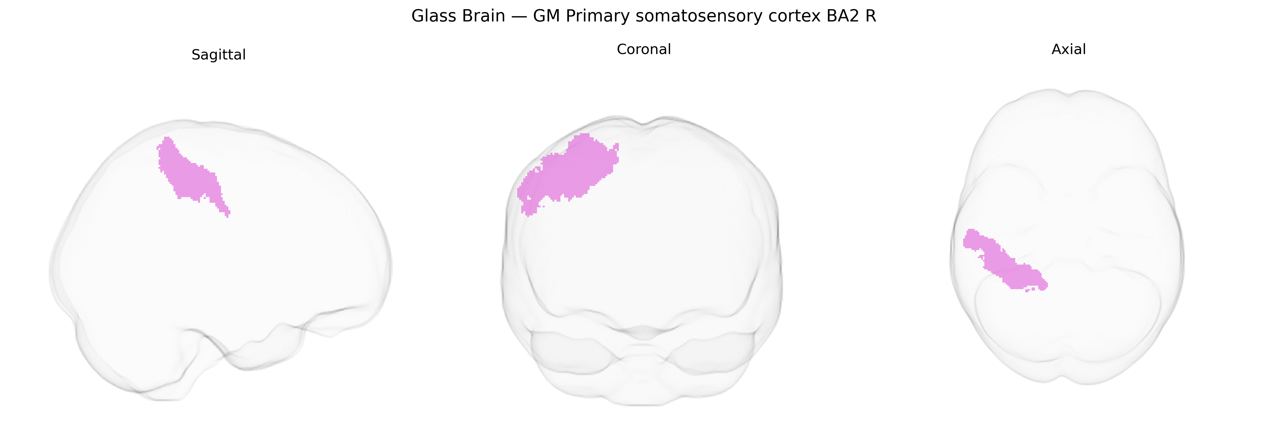Triplanar Ghost Brain