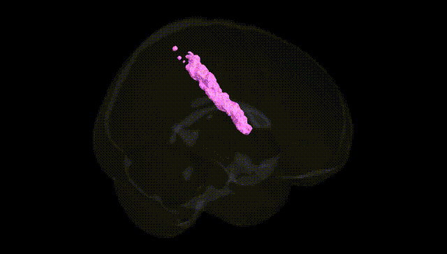 Full Brain Black