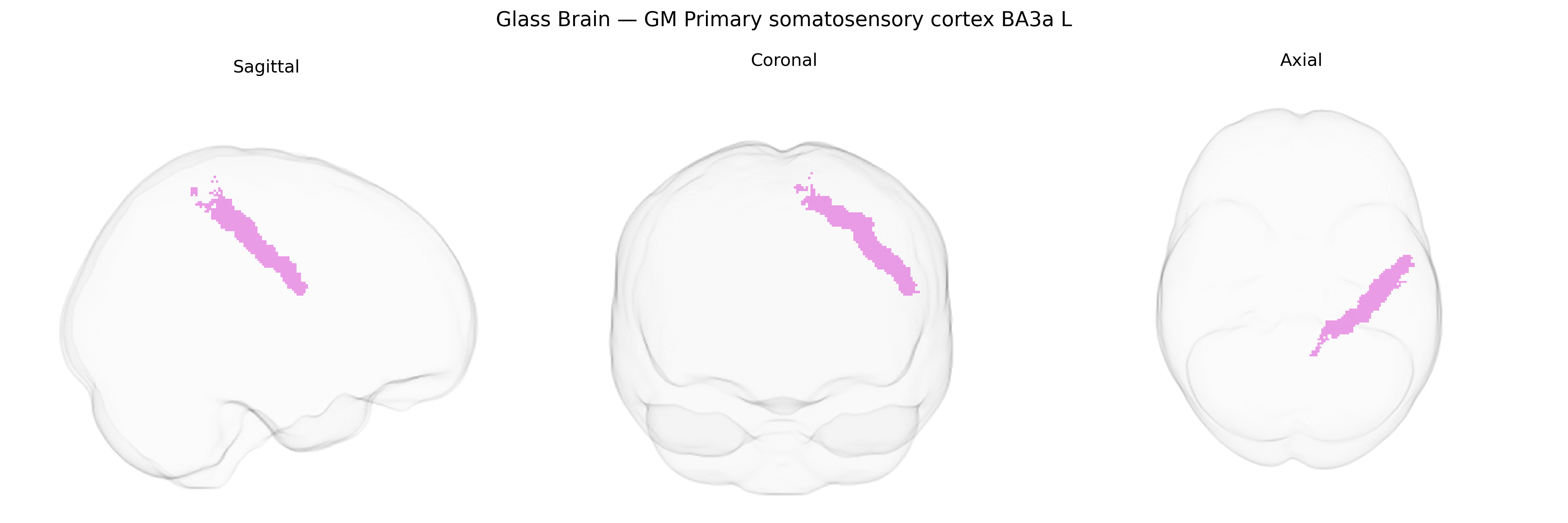 Triplanar Ghost Brain