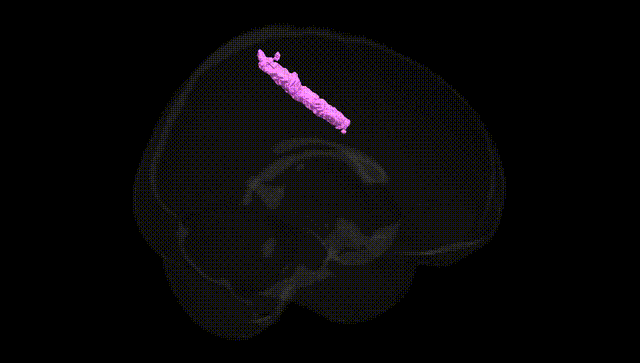 Full Brain Black