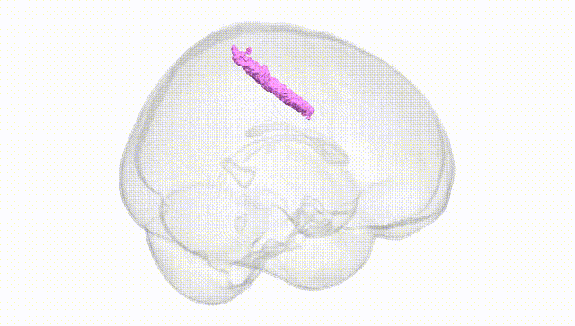 Full Brain White