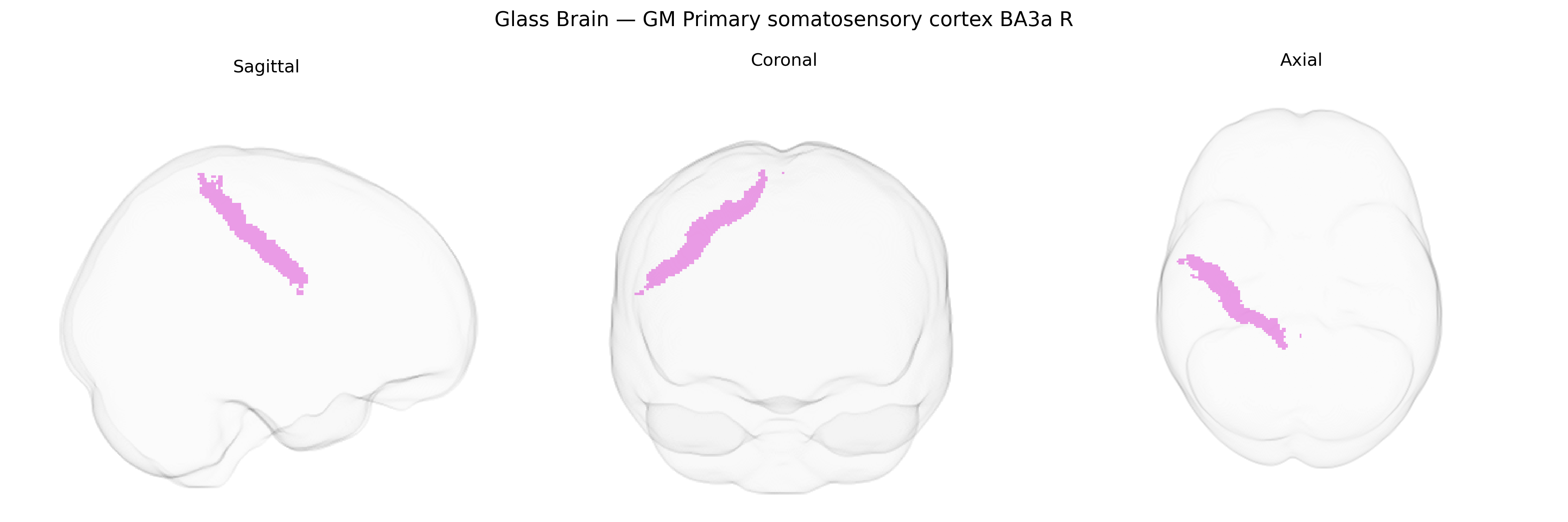 Triplanar Ghost Brain