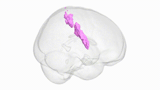 Full Brain White