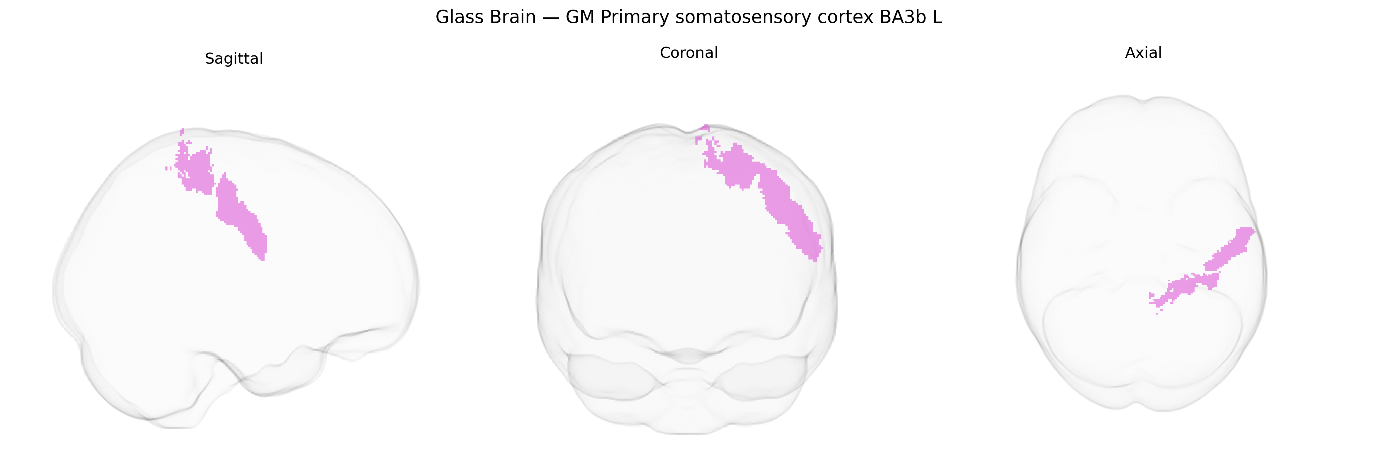 Triplanar Ghost Brain