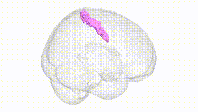 Full Brain White