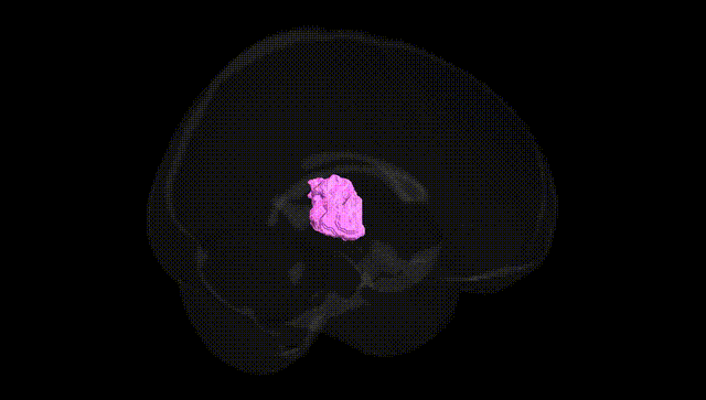 Full Brain Black