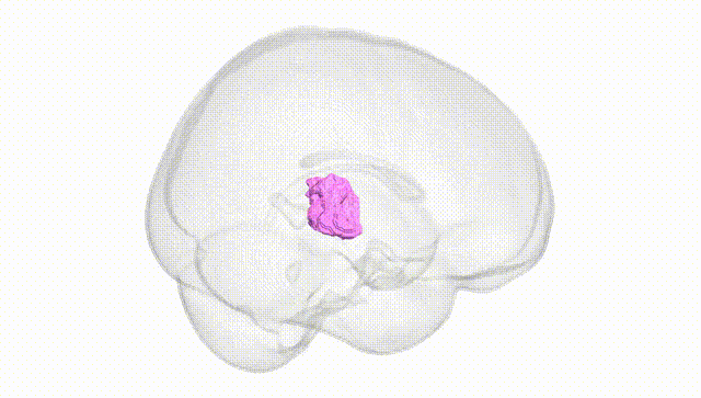 Full Brain White