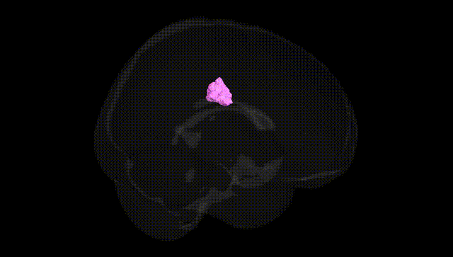 Full Brain Black