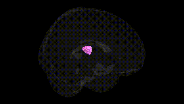 Full Brain Black