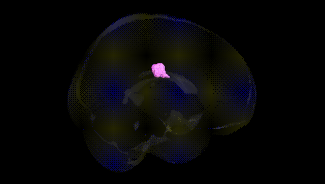 Full Brain Black