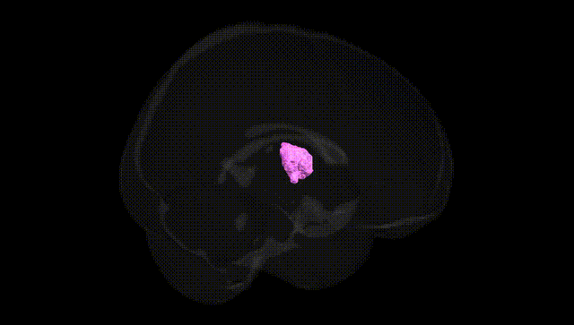 Full Brain Black