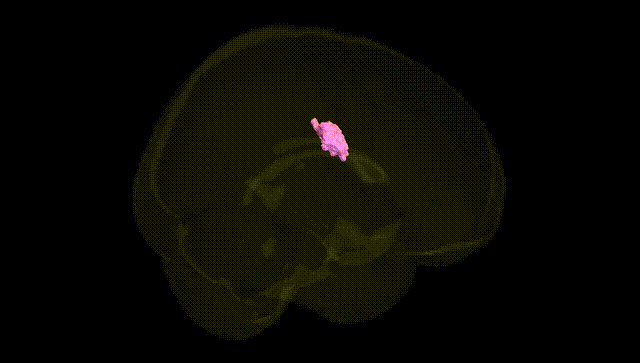 Full Brain Black