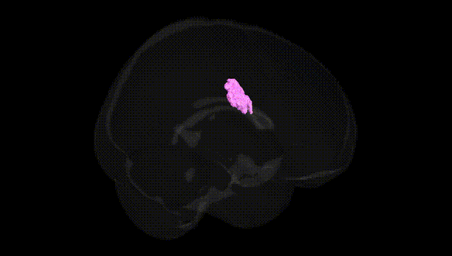 Full Brain Black