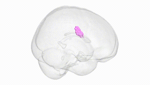 Full Brain White