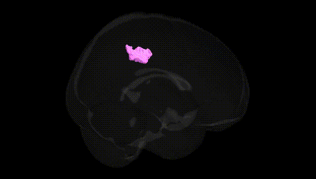 Full Brain Black