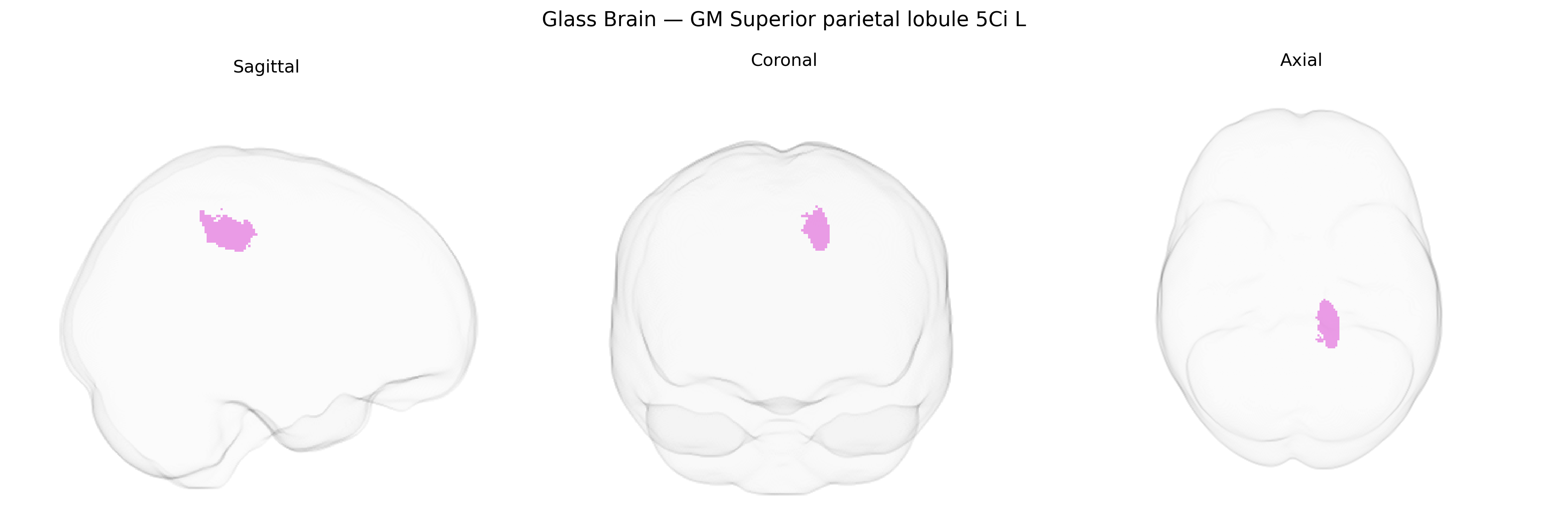 Triplanar Ghost Brain