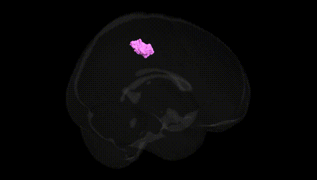 Full Brain Black