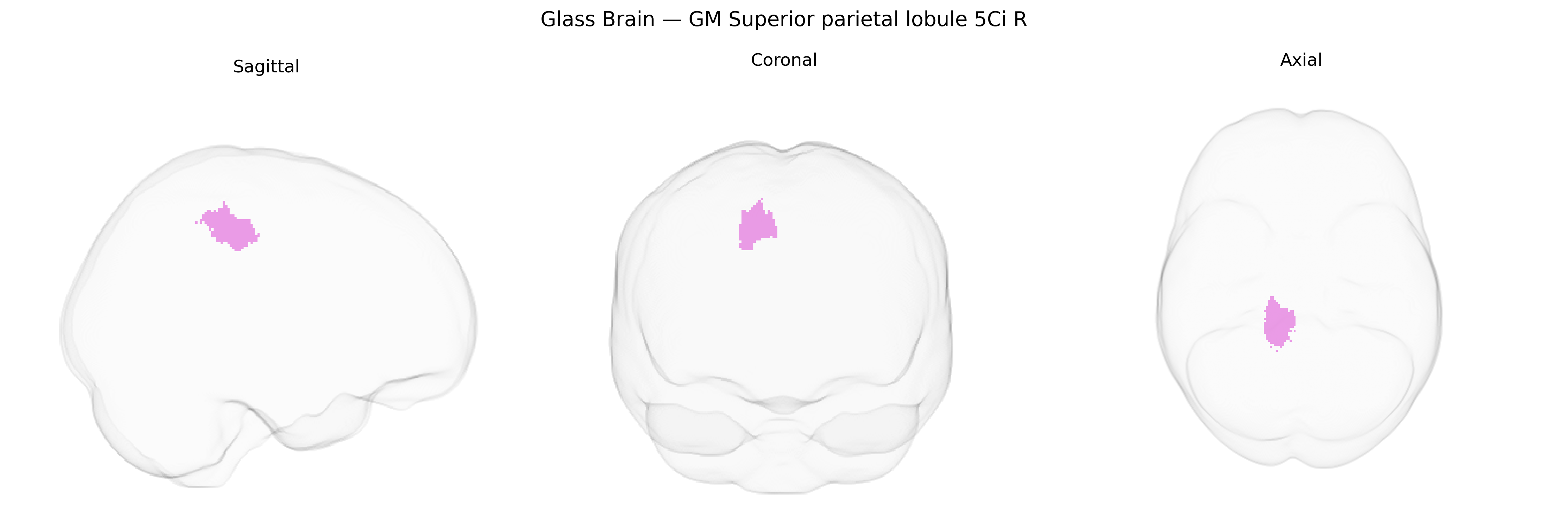 Triplanar Ghost Brain