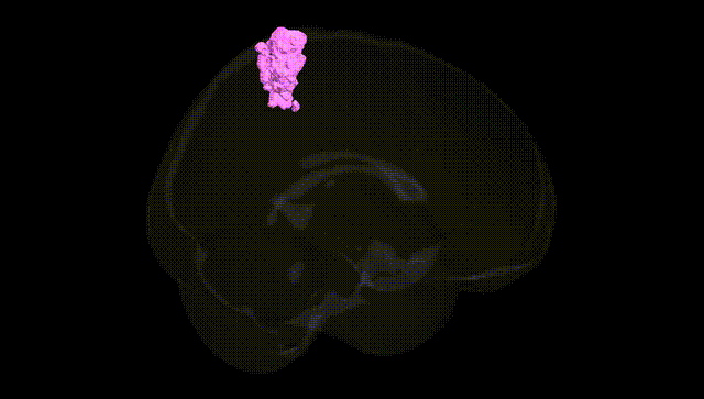 Full Brain Black