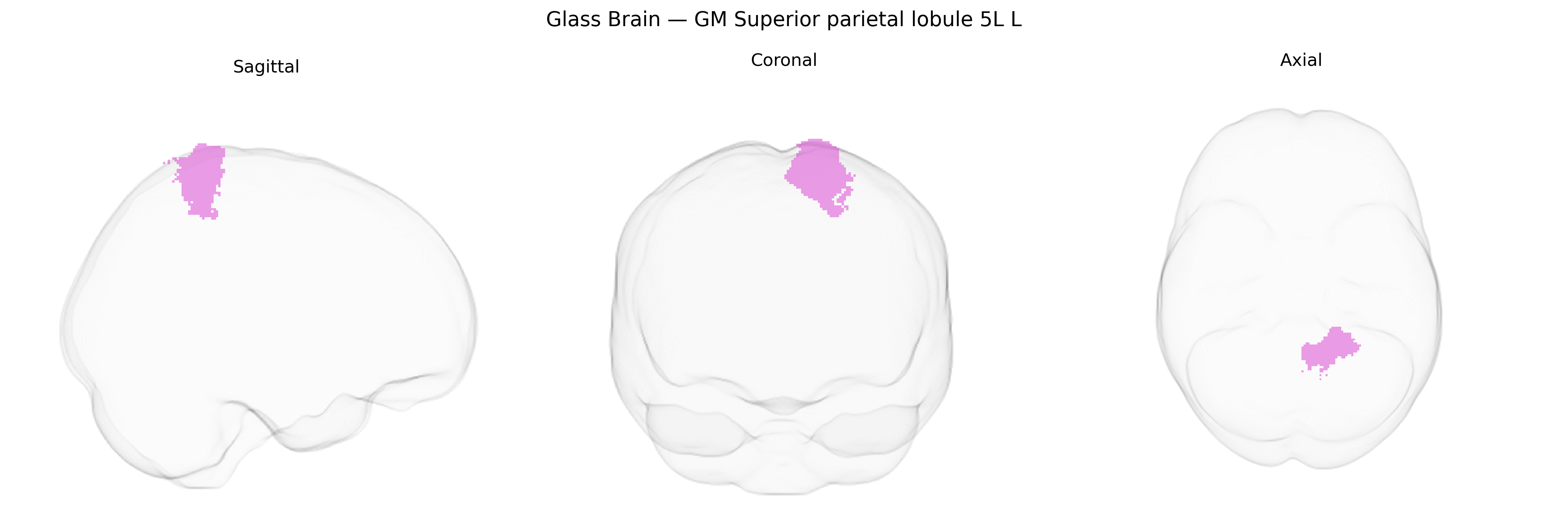 Triplanar Ghost Brain