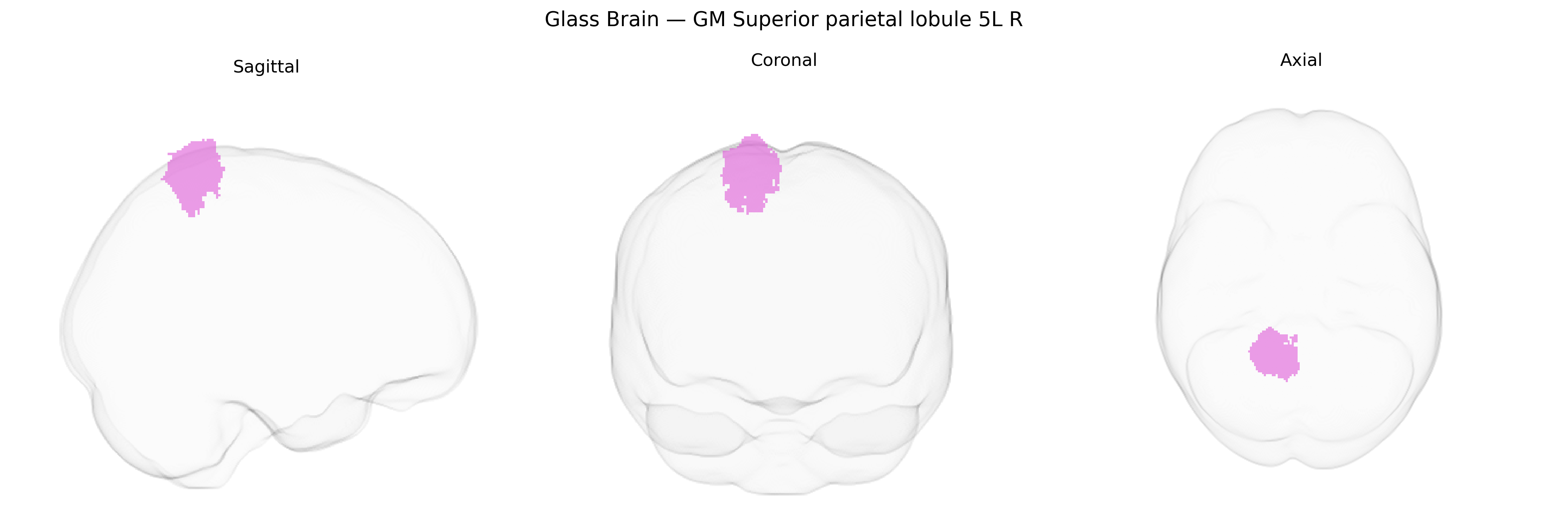 Triplanar Ghost Brain
