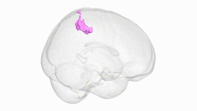 Full Brain White