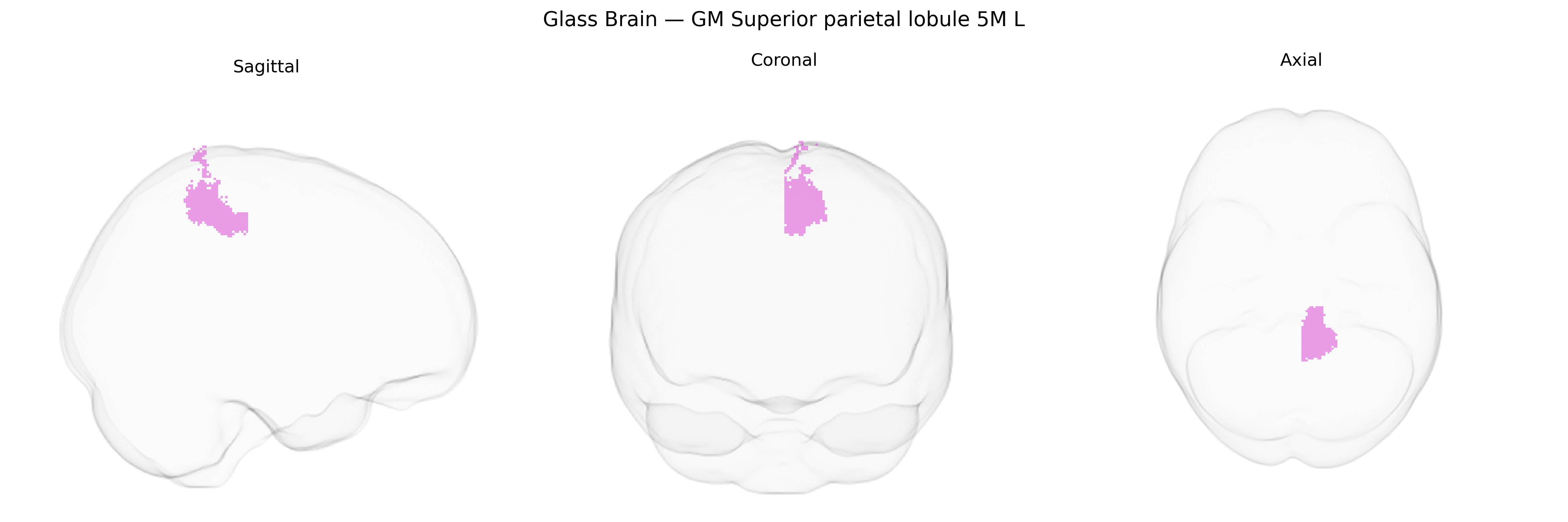 Triplanar Ghost Brain