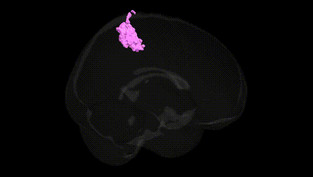 Full Brain Black