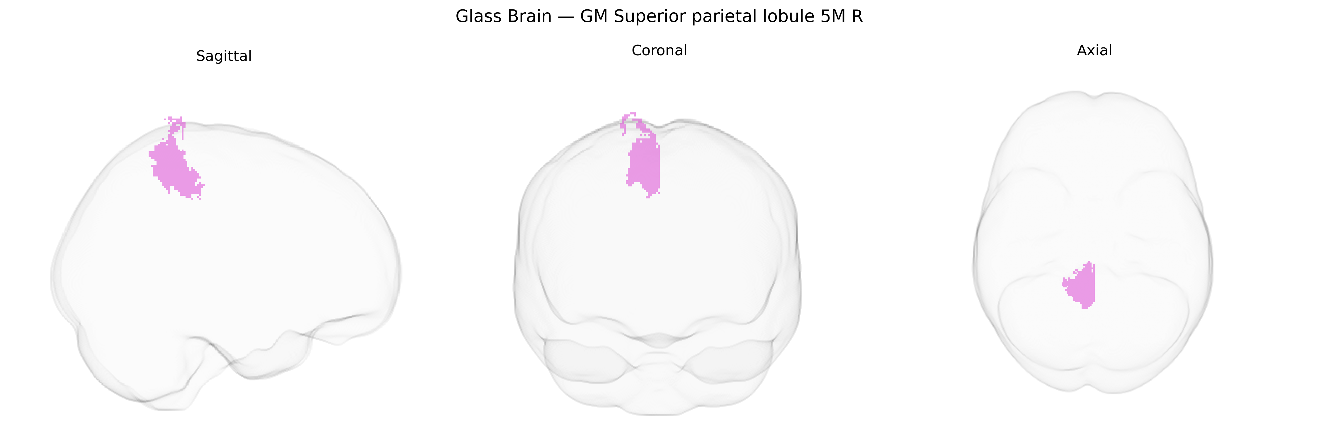 Triplanar Ghost Brain