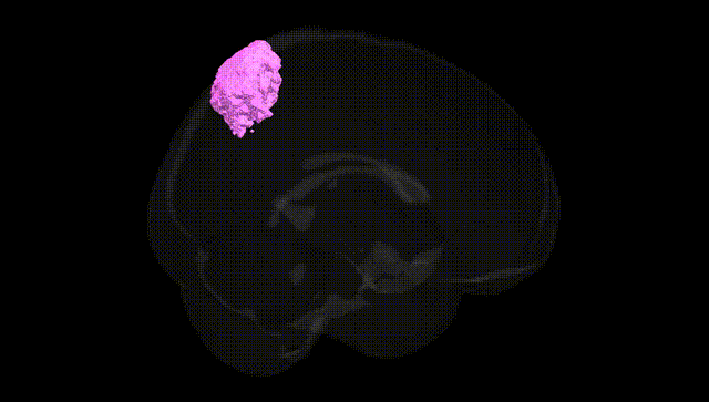 Full Brain Black