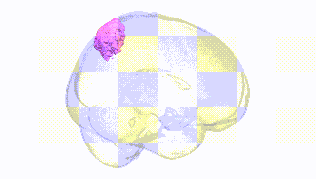 Full Brain White