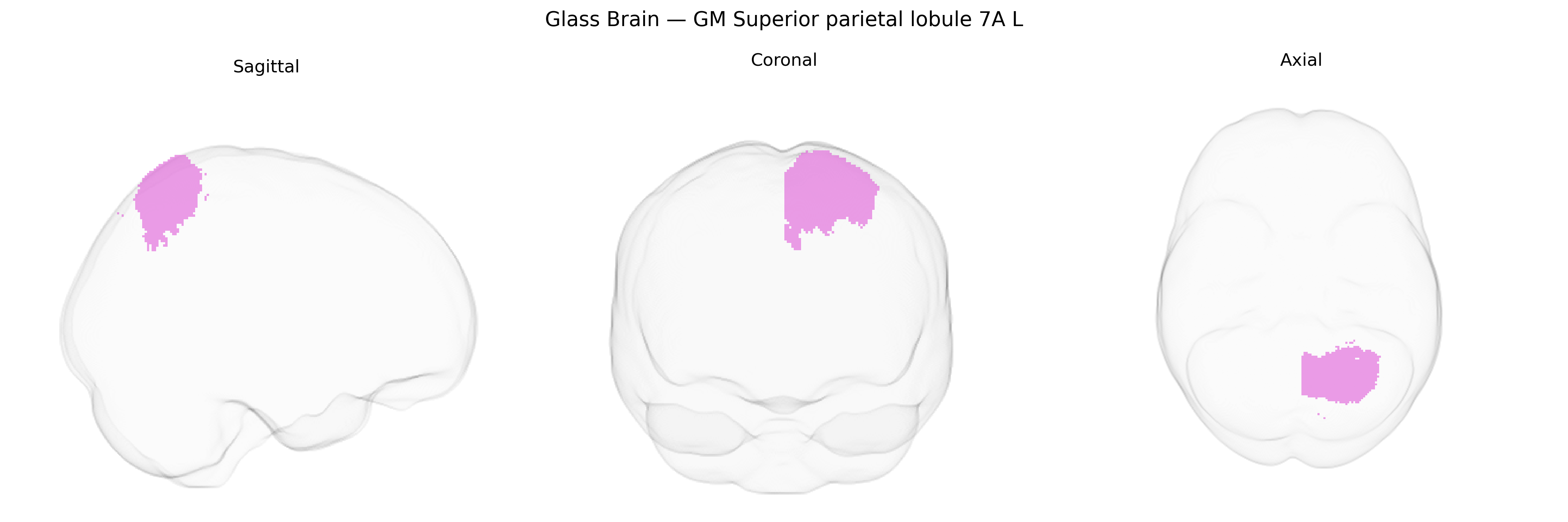 Triplanar Ghost Brain