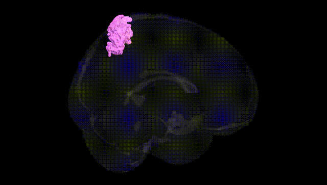 Full Brain Black