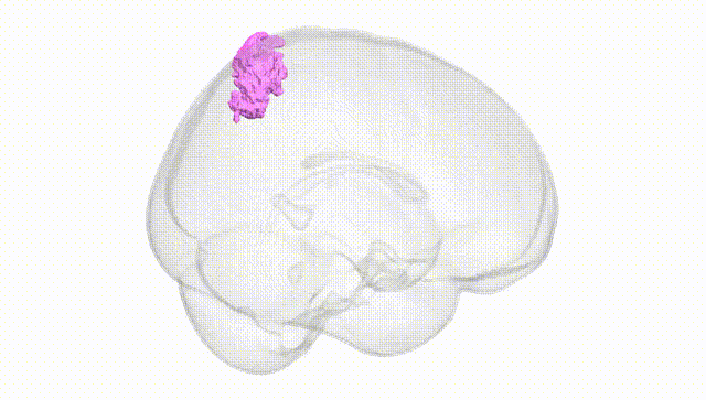 Full Brain White