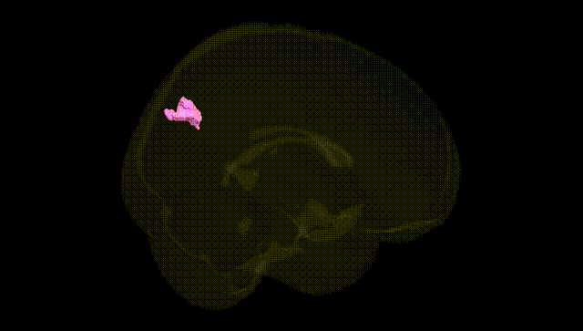 Full Brain Black
